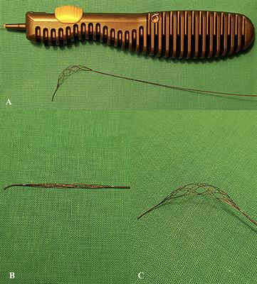 Safety and Efficacy of Mechanical Thrombectomy Using Tigertriever as a Rescue Device After Failed Aspiration—Single Center Experience